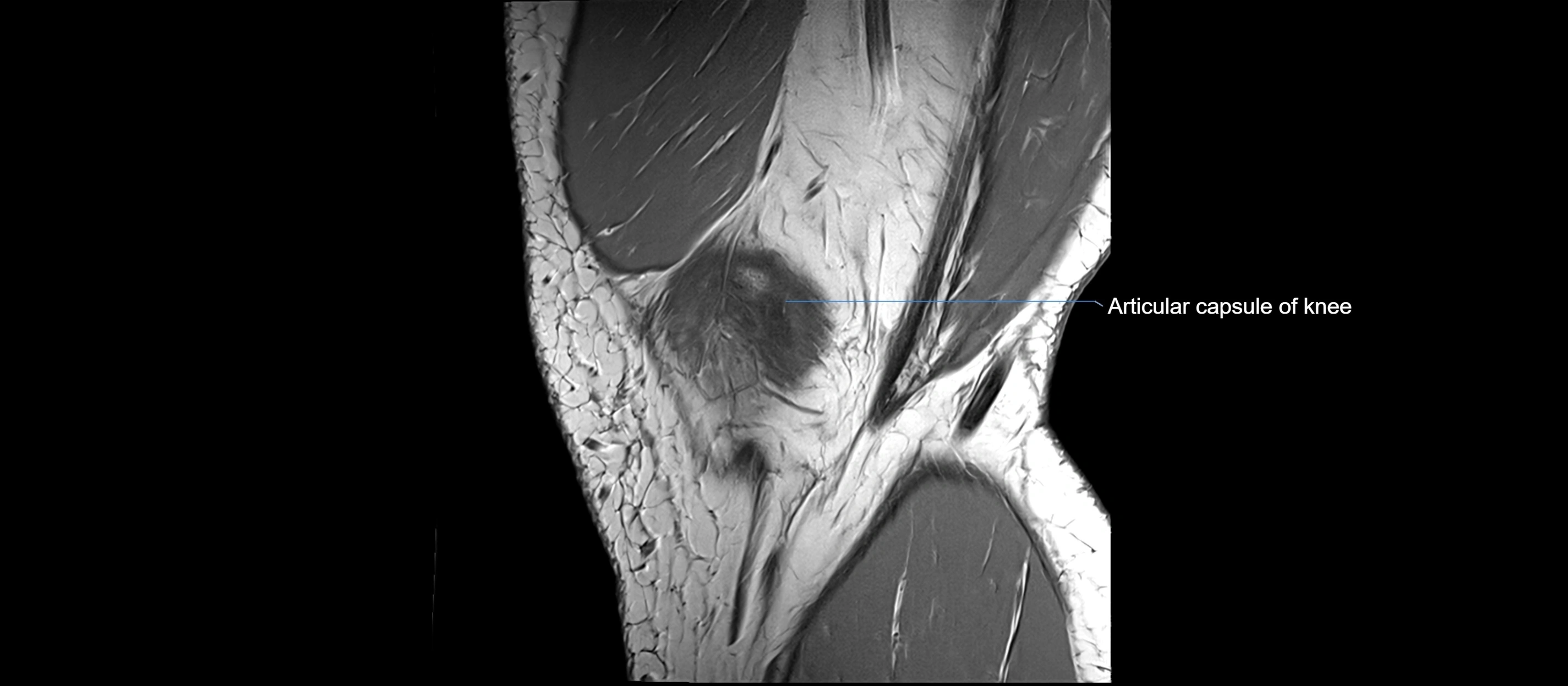MRI sagittal  ligaments cross sectional anatomy 3T  radiology  image-img-00001-00008.webp